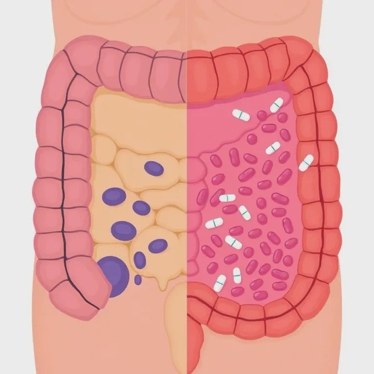 Illustration showing the impact of antibiotics on the colonic mucus barrier